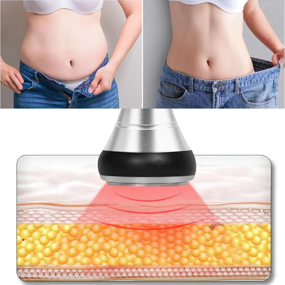 Beemyi 4 in 1 40K Cavitation Vacuum Body Slimming RF